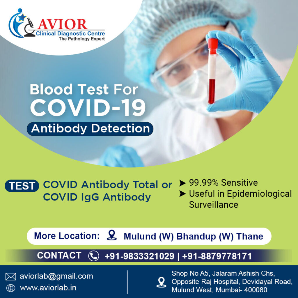 Blood Test For COVID-19 Antibody Detection Test